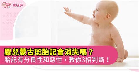 屁股 胎記|胎記？蒙古斑？如何觀察與判斷診治｜Mombaby 媽媽 